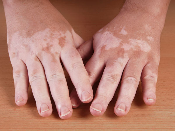 கொடிய நோய்கள்