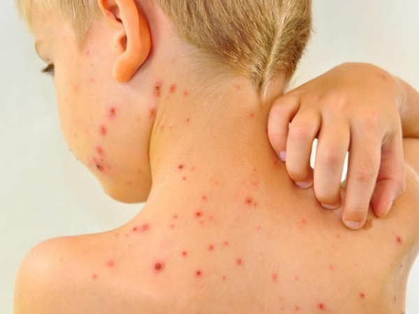 நோய்களுக்கு பரிகாரம்