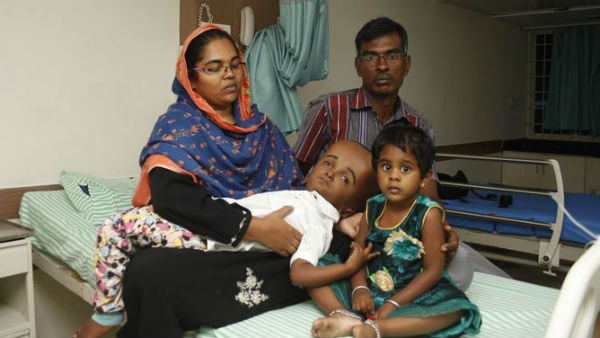 Hilal’s rare disease makes him look starkly different from other 7-year-olds 