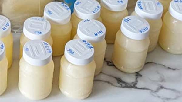 இறந்துவிட்டான் 