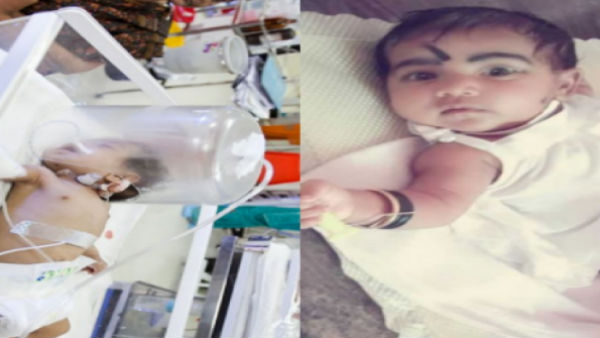 Need Money to save this one-year-old kid to get his liver transplant treatment 