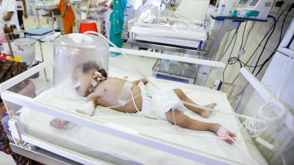 Need Money to save this one-year-old kid to get his liver transplant treatment 