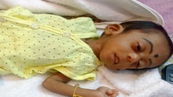 Help to save my 6 month old Baby From Glaucoma 