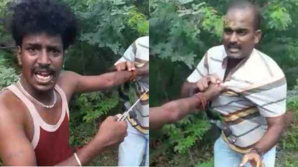எலும்பு முறிவு 