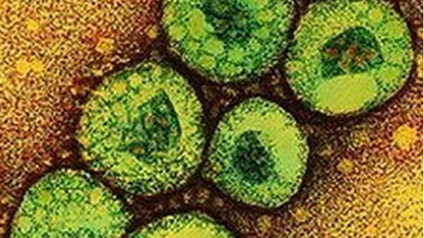 கொரோனா வைரஸின் பொதுவான அறிகுறிகள் 