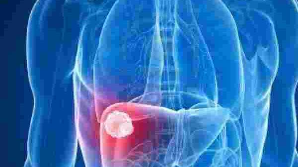 புற்றுநோய்கள் 