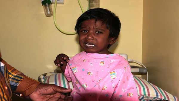 Help to save 2 year old baby Vignesh Heart problem 