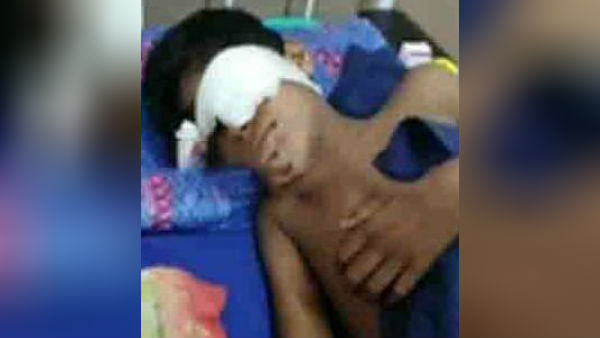 கண் பார்வை 