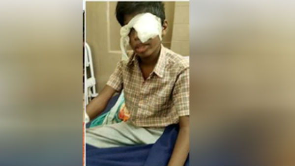 தலையில் காயம் 