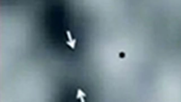 யாருடைய ரத்தத்தில் இருந்து எடுத்தது 