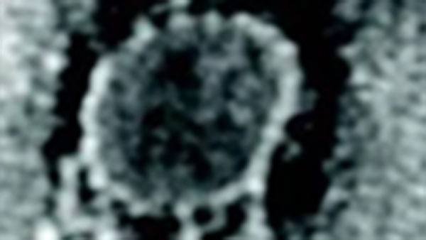 எப்படி வைரஸ் மாதிரியை எடுத்தார்கள் 