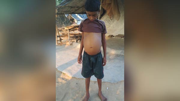  Help 7 year old Teejeesh Liver Transplant operation