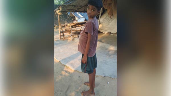  Help 7 year old Teejeesh Liver Transplant operation