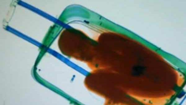 சூட்கேஸ் 