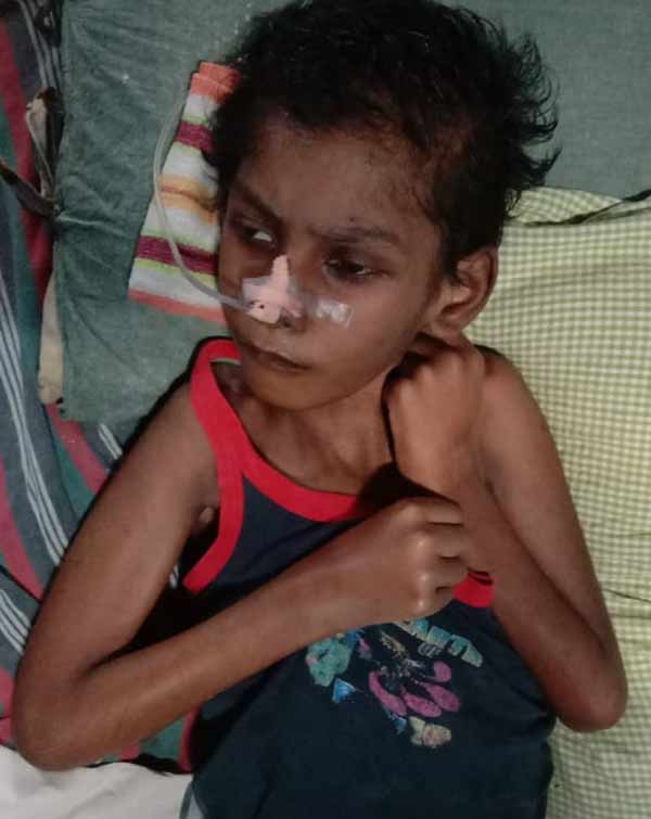 Small boy affected with Adrelo leuko dystrophy issue, need financial help 