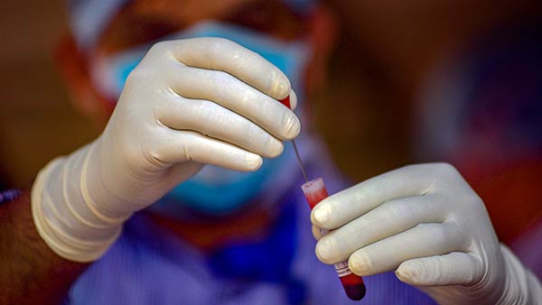  சிகிச்சைகள் 