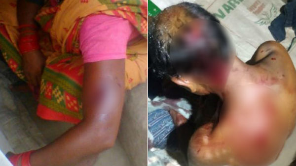  4 பேருக்கு ரத்த காயம்