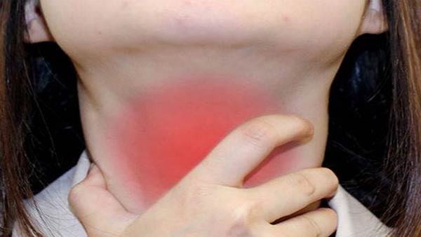 நிமோனிக் பிளேக் 