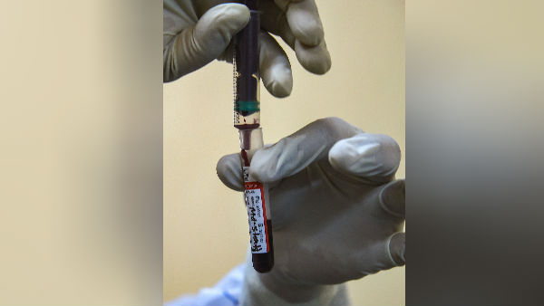 பிளாஸ்மா 