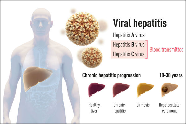 Harvey J Alter, Michael Houghton and Charles M Rice win Nobel Medicine award Harvey J Alter, Michael Houghton and Charles M Rice win Nobel Medicine award