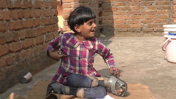 Encephalopathy - a brain disease puts 4-year-old Divya’s life in danger 
