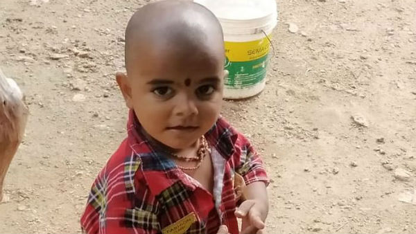 Poor parents can only watch their son suffer, Help them save him 