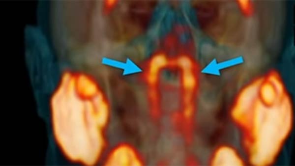 நோயாளிக்கு சிக்கல் 