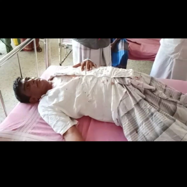 மாஸ்டரும் படுகாயம் 