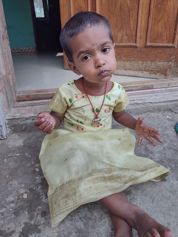 Help to save 1 year old Thanushree from serious Heart problem 
