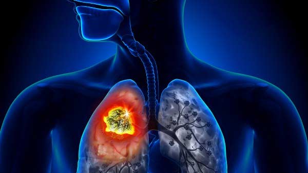 நச்சுத் தன்மை நச்சுத் தன்மை