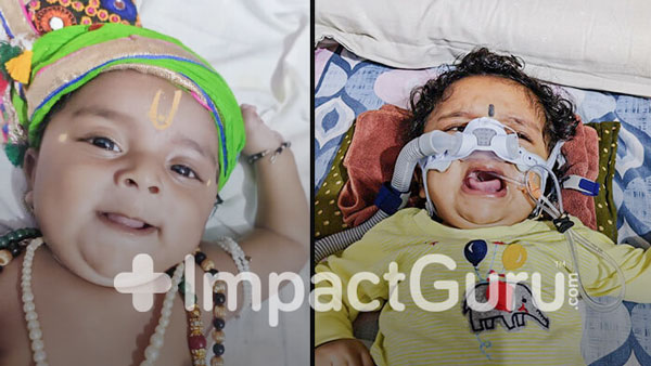 Baby Janish Needs A Wonder Drug To Survive SMA. Help 