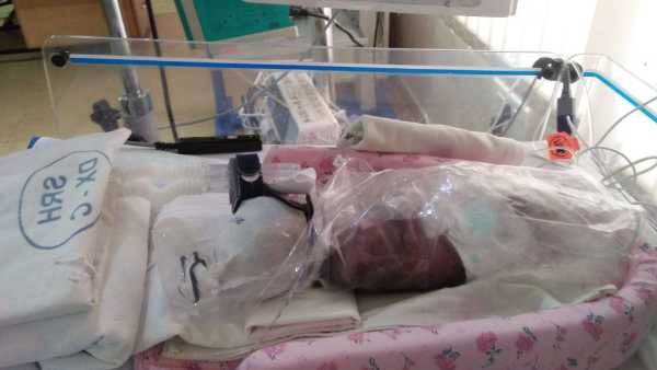 4 weeks old premature baby need your support to survive