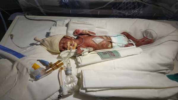 4 weeks old premature baby need your support to survive