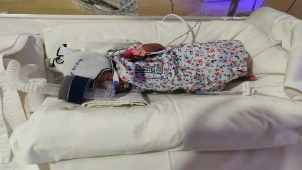 4 weeks old premature baby need your support to survive