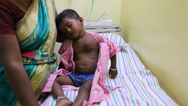  Help 2 year brindha recover from heart problem