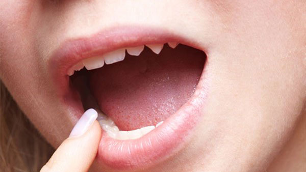 நாக்கில் புள்ளிகள் 