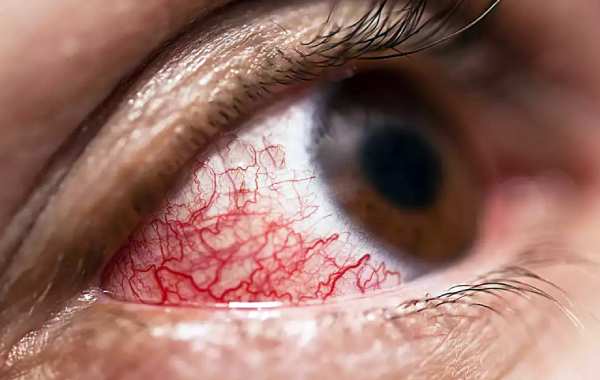 நோய் அறிகுறிகள் 