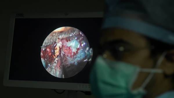  எத்தனை பேருக்குக் கருப்பு பூஞ்சை பாதிப்பு