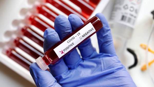 கொரோனா பாசிட்டிவ்