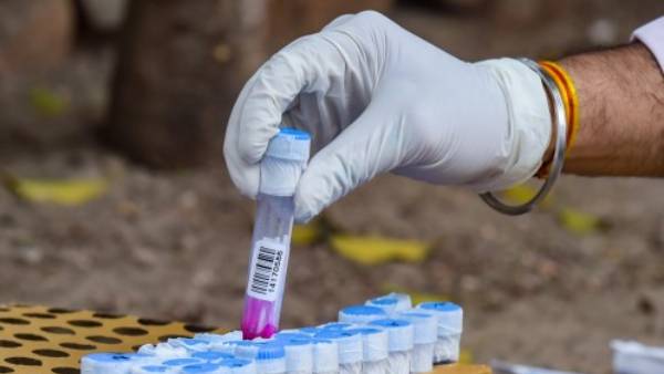 நாட்கள் குறைப்பு 