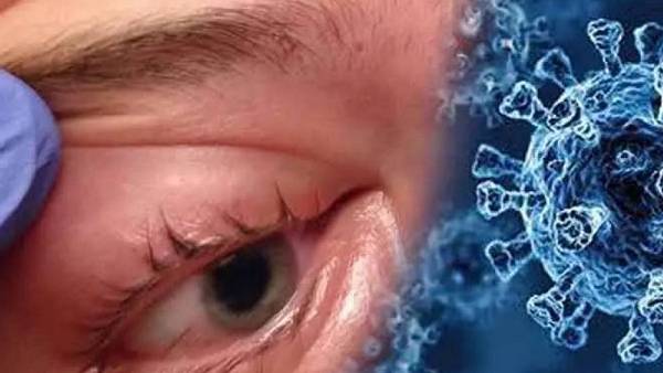 கருப்பு பூஞ்சை 