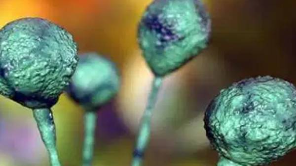 நீக்கம் 