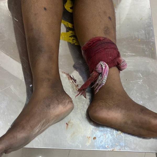 போலீசை சுட்ட ரவுடி 