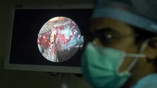 கலக்கம்