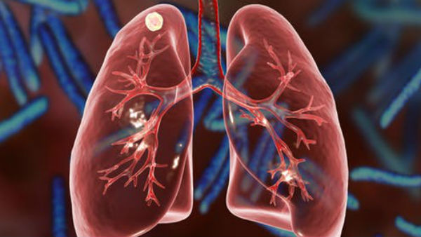 முயற்சி 