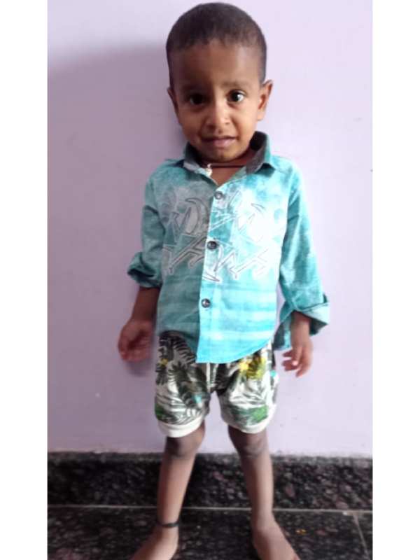 Help 1.5 years old devanesh Recover from heart Problem