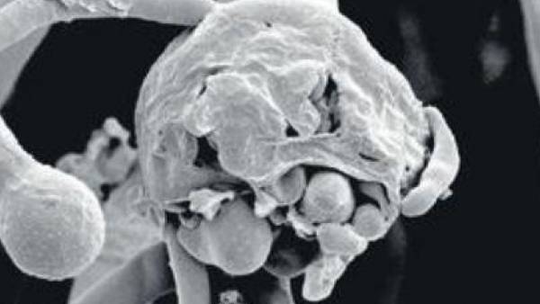 சந்தேகங்கள் 