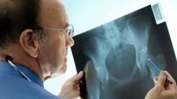 கோவையில் கருப்பு பூஞ்சை பாதிப்பு 