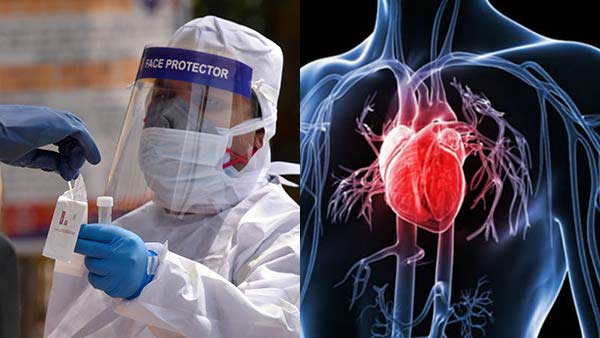 மாரடைப்பு