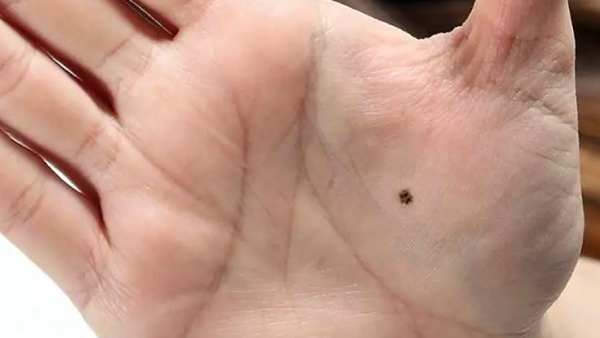 நெஞ்சில் மச்சம் 